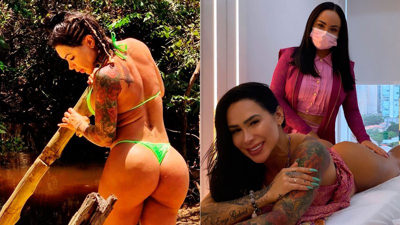 Fabiana Frota recorreu a procedimento para turbinar ainda mais o bumbum - Foto: Reprodução/ Instagram@fabiforta77 e @clinicaroundgluteo