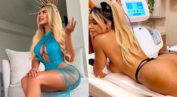 Janaina Prazeres fez procedimentos com colágeno no bumbum e no rosto - Foto: Reprodução/ Instagram@janaina3