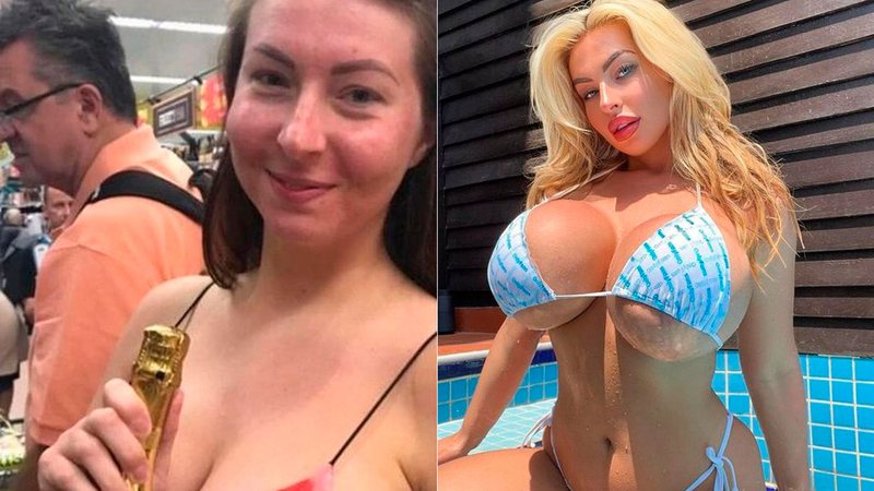 Maddison Fox antes e depois das plásticas que custaram R$ 180 mil - Foto: Reprodução/ Instagram@maddisonfox__