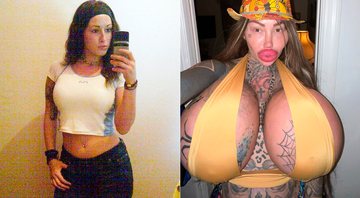 Mary Magdalene antes e depois das cirurgias plásticas - Foto: Reprodução/ Instagram@1800leavemaryalone