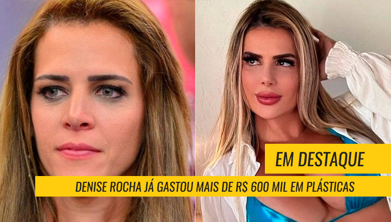 Denise Rocha plásticas